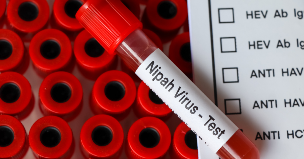 How is the Nipah Virus Tested