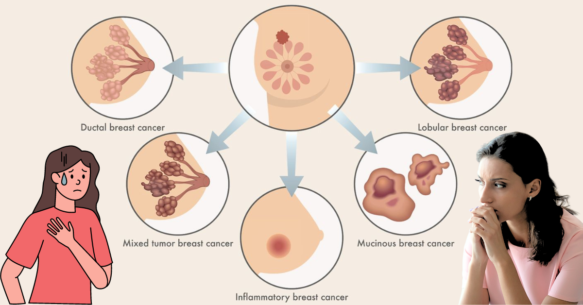 Can Breast Cancer Cause Death-What is the Relation of Pink Ribbon and Breast Cancer?